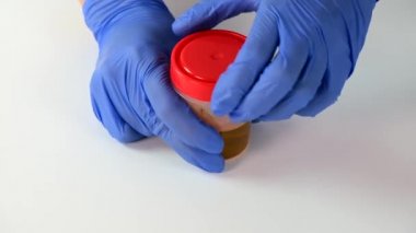 Doktor ya da laboratuvar teknisyeni, tıbbi laboratuvar, tıbbi idrar testi ve sağlık taraması için idrar örneği ve araştırma içeren bir kap açıyor..