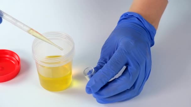 Doctor or laboratory technician dials urine from container with sample for analysis and research in medical laboratory, medical urine test and health scanning — Stock Video