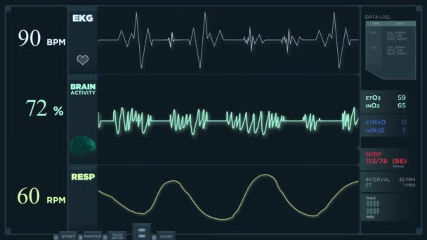 Animation einer schnellen Anzeige des Elektrokardiogramms. — Stockvideo