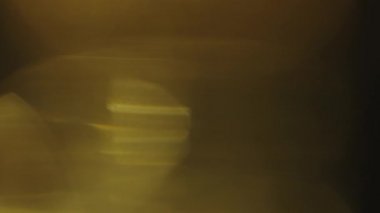Parlak lensler ve romantik bokeh