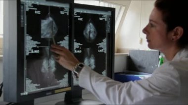 Genç kadın doktor hasta Famale meme kanseri araştırmaları bilgisayardaki sonuçlarını inceler