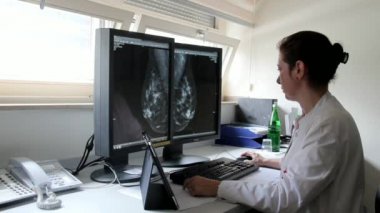 Genç kadın doktor hasta Famale meme kanseri araştırmaları bilgisayardaki sonuçlarını inceler