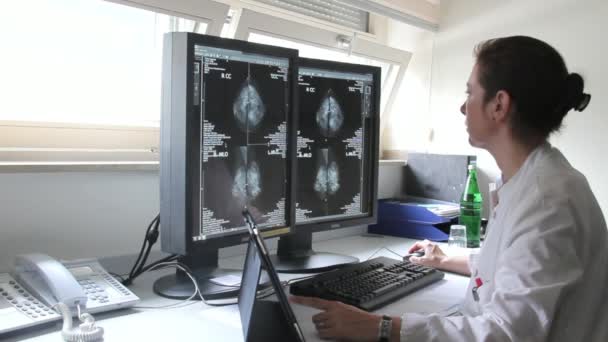 Une jeune femme médecin examine les résultats de la recherche sur le cancer du sein Famale sur ordinateur — Video