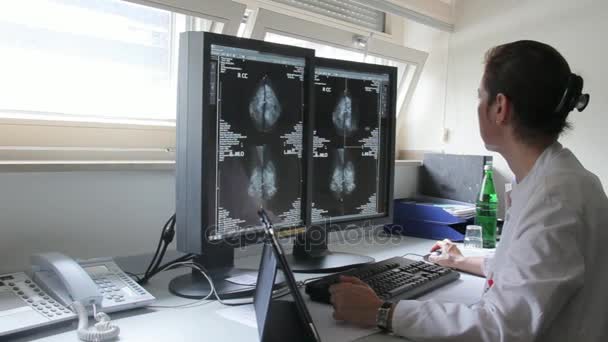 Junge Ärztin untersucht Ergebnisse der Brustkrebsforschung von Patientin famale am Computer — Stockvideo