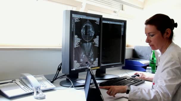 Young Woman Doctor Examines the Results of Patient Famale Breast Cancer Research on the Computer — Stock Video