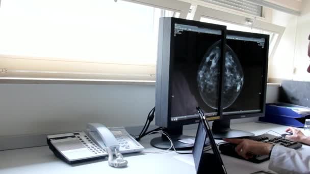 Молодая женщина-врач изучает результаты исследования рака молочной железы у пациентов на компьютере — стоковое видео