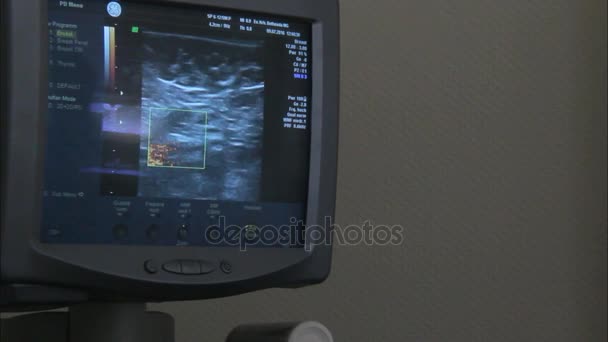 Ultrasoud of Patient Famale Breast — Stock Video