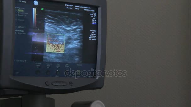 Ultrasoud of Patient Famale Breast — Stock Video