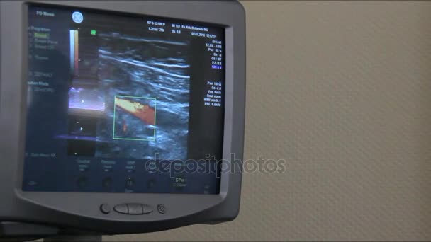 Ultrasoud of Patient Famale Breast — Stock Video