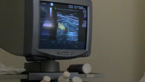 Ultrasoud av patientens famale bröst — Stockvideo