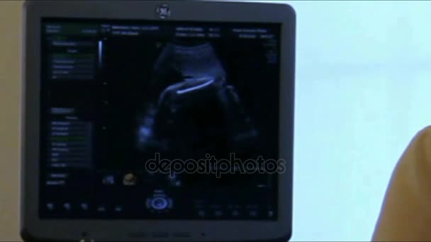 Läkare att göra ultraljud av en gravid kvinna — Stockvideo