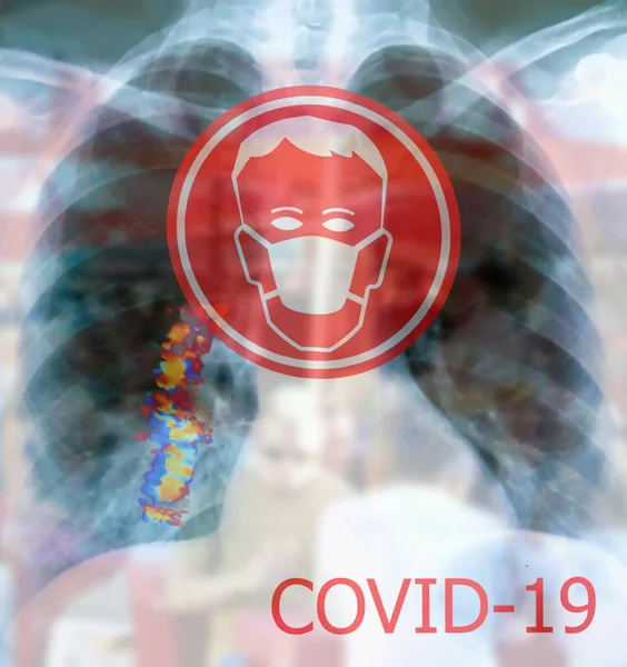 Medical mask for protection against flu and other diseases on x-ray of the lungs with traces of the inflammatory process background. Stop COVID-19