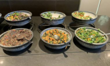 İki insan elinin de kemiklerinin röntgen plakası.