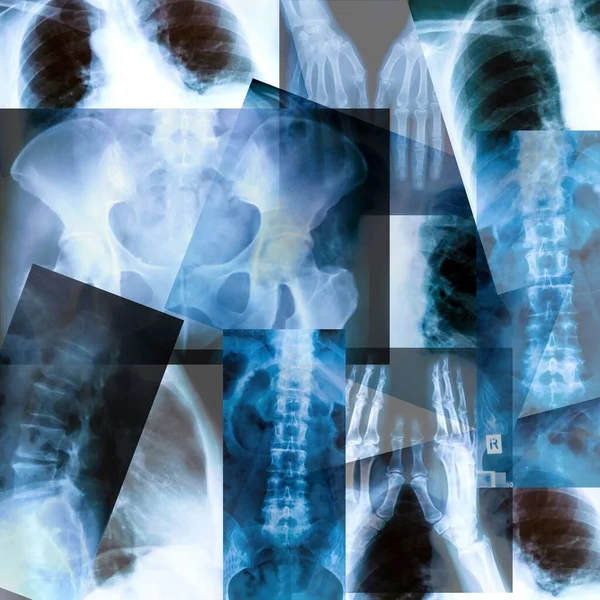 Uppsättning Röntgenplattor Olika Delar Människokroppen — Stockfoto