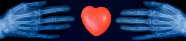 Insan Elinin Kırmızı Kalp Işaretinin Röntgen Tablosu — Stok fotoğraf