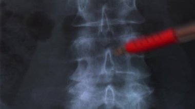 Doktor insan omurgasının kemiklerinin röntgenini inceliyor, 4k