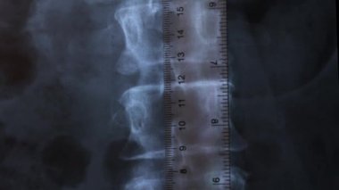 Doktor insan omurgasının kemiklerinin röntgenini inceliyor, 4k