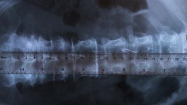 Doktor insan omurgasının kemiklerinin röntgenini inceliyor, 4k