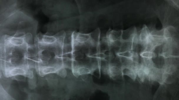 X-ray of the bones of the human vertebral column and pelvis, 4K — Stock Footage Ray Bones Human Vertebral Column Pelvis Stock Video