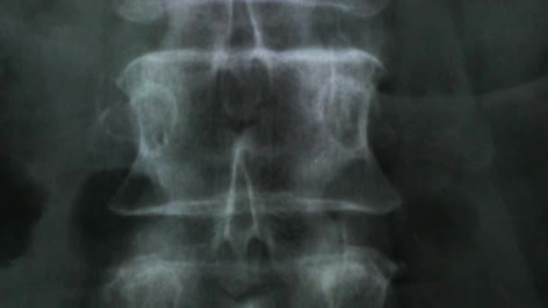 Radiografía Los Huesos Columna Vertebral Humana Pelvis — Vídeos de Stock