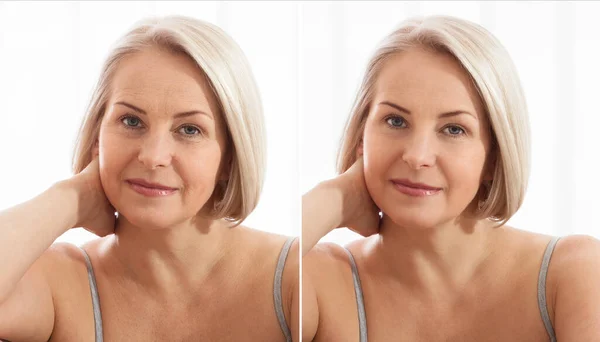 Middle age close up woman happy face before after cosmetic procedures. Skin care for wrinkled face. Before-after anti-aging facelift treatment. Facial skincare and contouring. — Stock Photo, Image