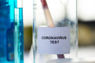 Laboratuvarda Coronavirus testi, covid 19 salgın hastalığı.