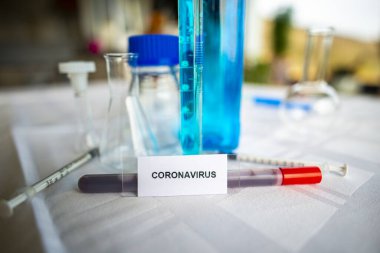 Laboratuvarda Coronavirus testi, covid 19 salgın hastalığı.