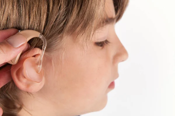 Primo piano di una mano che inserisce un apparecchio acustico nell'orecchio di un ragazzo — Foto Stock