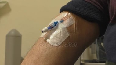 Damar içi kateter dirsek damar içine eklenen