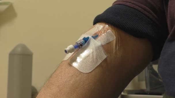 Intravenous catheter inserted into elbow vein — Stock Video