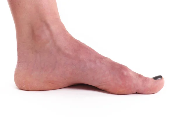 白种白健康女性脚裸红色脚趾钉在白色背景下被隔离 — 图库照片