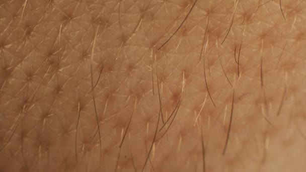 Macro shot of hairs growing from the skin on the hand or arm. Body parts of white male caucasian. Dermatology and skincare. — Stock Video