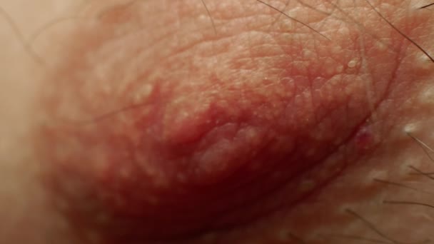 Macro a human male one nipple and areola with hairs. Closeup. Body parts of white caucasian. Dermatology and skincare. Normal and healthy directly view — Stock Video