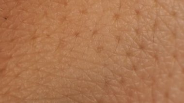 İnsan derisi dokusu, yakın plan. Kuru cilt bakımı kavramı. Deriyi, arka planı, üst deriyi nemlendirir ve besler.