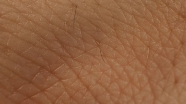 Menselijke huidtextuur, close-up. Een droog huidverzorgingsconcept. hydraterende en voedende de huid, achtergrond, epidermis — Stockvideo