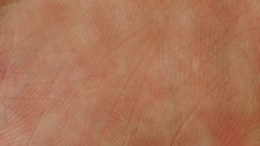 Bir adamın avucundaki çizgiler, doku, makro. dermatoloji ve sıhhiye