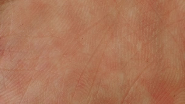 Líneas en la palma de la mano de un hombre, textura, macro. dermatología y medicina — Vídeos de Stock