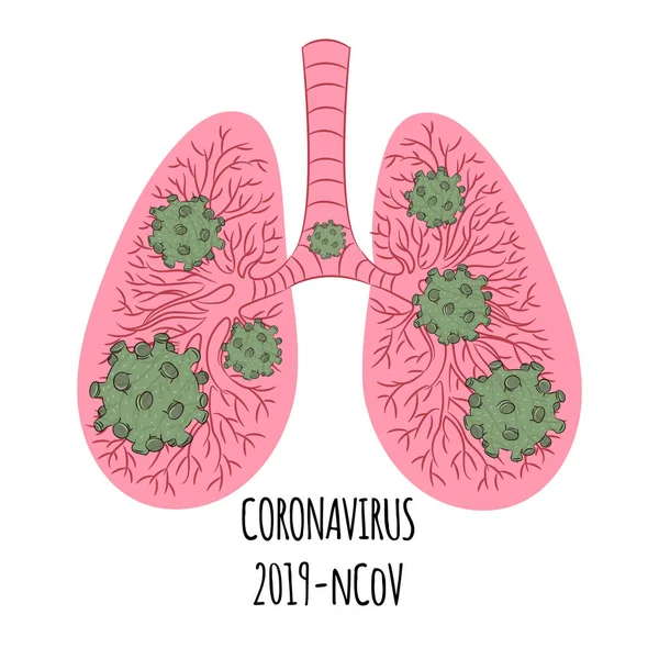 Pneumonía Coronavirus Pandemia Tierra Humana Ilustración Del Vector Cólera — Archivo Imágenes Vectoriales