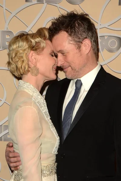 Anne Heche, James Tupper — Photo