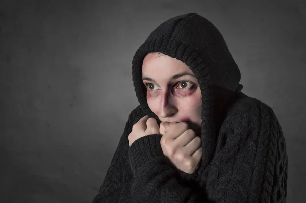 Mulher com hematomas vítima de violência doméstica ou acidente . — Fotografia de Stock