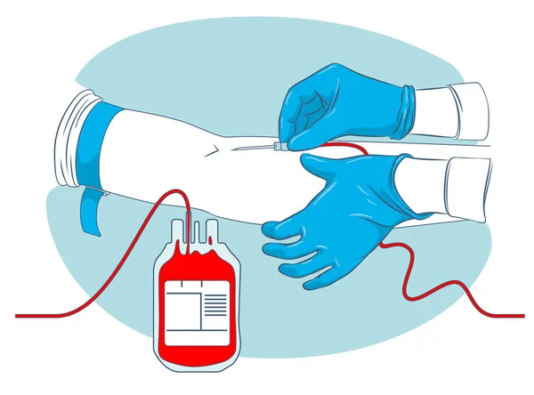 Proceso Recolección Sangre Del Donante Las Manos Una Enfermera Preparan — Archivo Imágenes Vectoriales