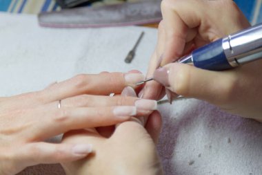 Dönüm uzantısı çivi