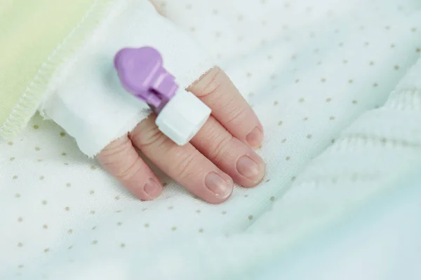 Kéz katéter újszülött baba — Stock Fotó