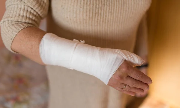 Mujer con mano en yeso . —  Fotos de Stock