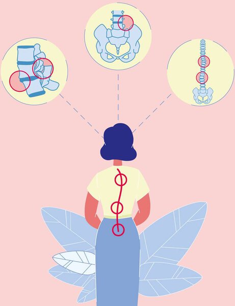 Cartoon Woman Standing Back with Spinal Curvature