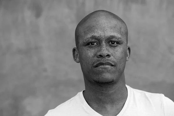 African man with freckles staring — Stock Photo, Image