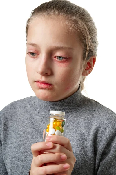 Reacción alérgica, erupción cutánea, retrato de la cara de una niña. Enrojecimiento e inflamación de la piel de los ojos y labios. Enfermedad del sistema inmunológico. Frasco de tabletas y pastillas en la mano del niño . — Foto de Stock