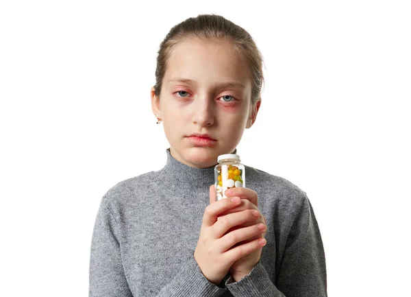 Allergic reaction, skin rash, close view portrait of a girl's face. Redness and inflammation of the skin in the eyes and lips. Immune system disease. Bottle of tablets and pills in child hand. — 스톡 사진