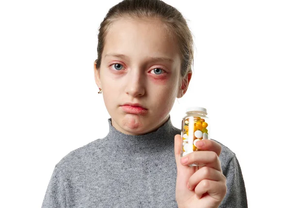 Reacción alérgica, erupción cutánea, retrato de la cara de una niña. Enrojecimiento e inflamación de la piel de los ojos y labios. Enfermedad del sistema inmunológico. Frasco de tabletas y pastillas en la mano del niño . — Foto de Stock