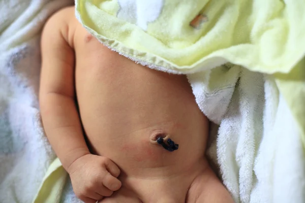 Cordon ombilical du nouveau-né — Photo